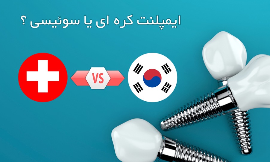 قیمت ایمپلنت سوئیسی