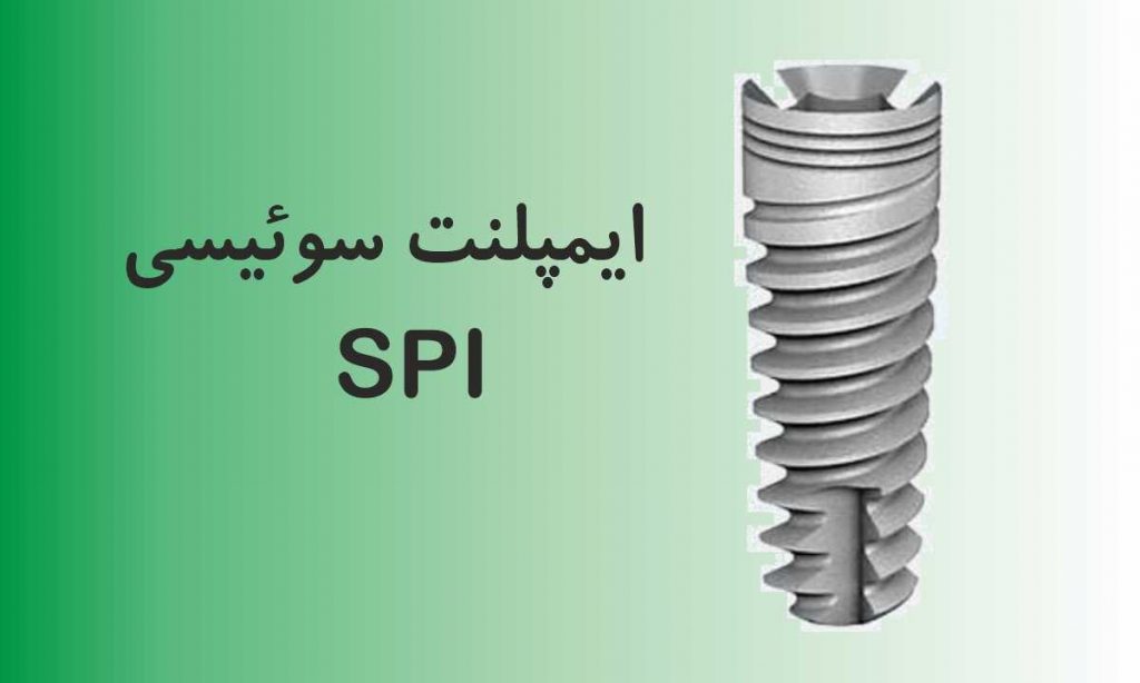 قیمت ایمپلنت سوئیسی