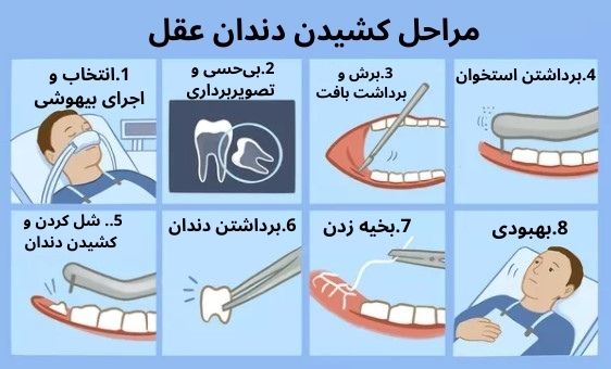 جراحی دندان