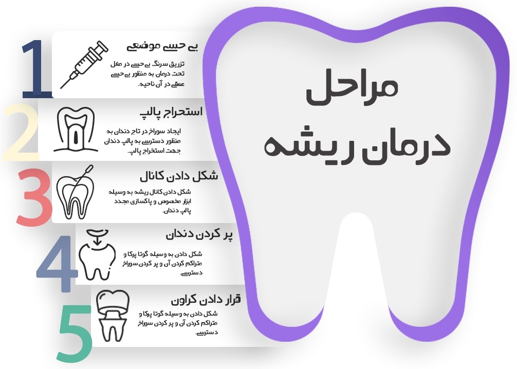 درمان ریشه دندان