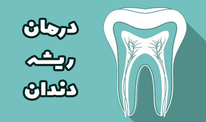 درمان ریشه دندان