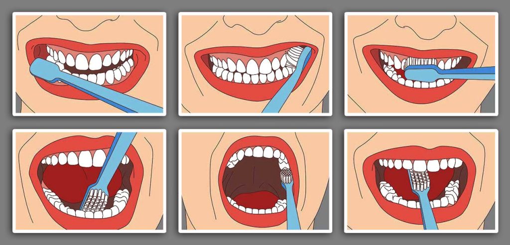 آشنایی با روش صحیح مسواک زدن و 10 نکته طلائی آن | دکتر والا