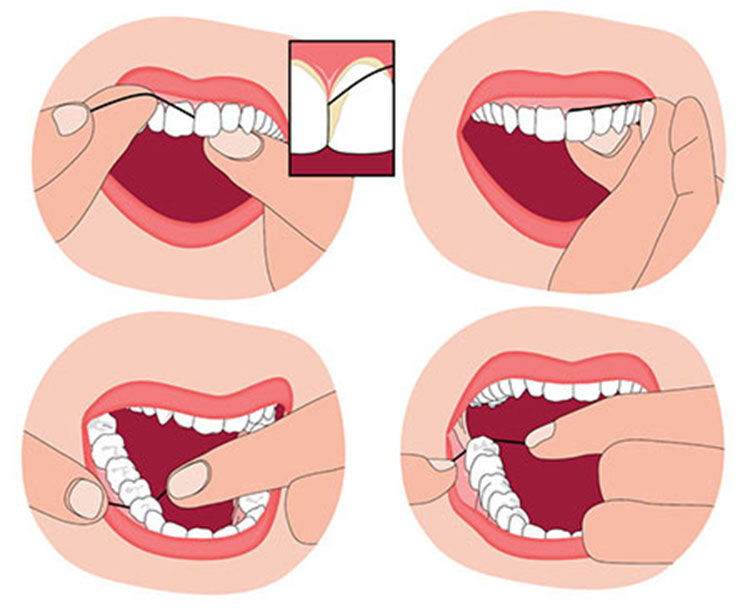 استفاده صحیح از نخ دندان