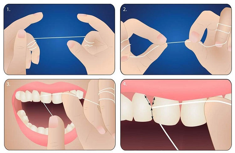 استفاده صحیح از نخ دندان